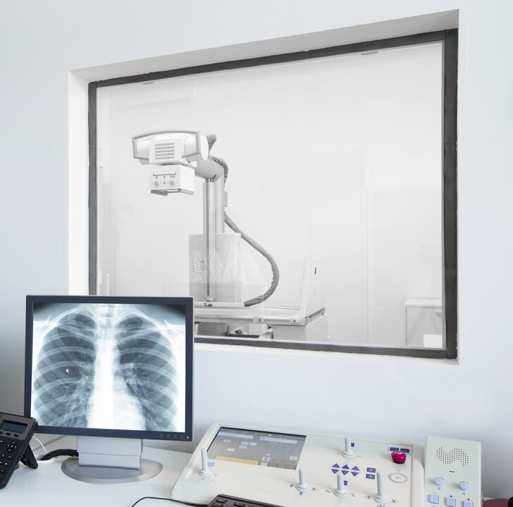 Рентгенова снимка на гръбначния стълб - основният метод за диагностициране на остеохондроза