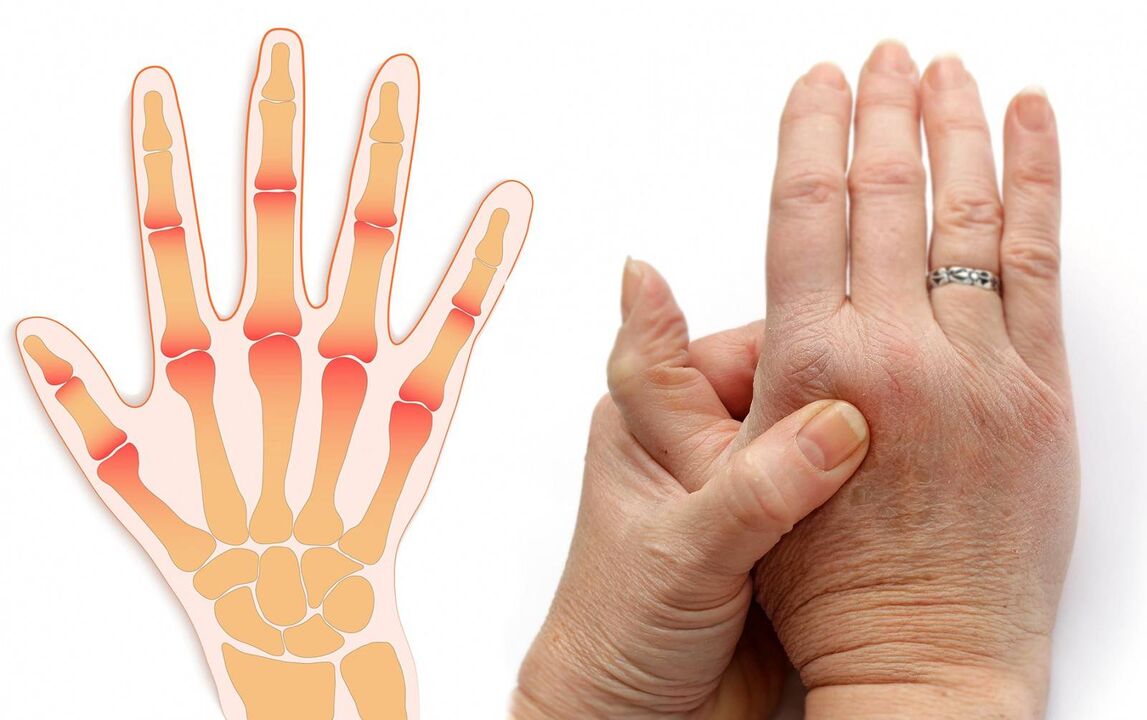 заболявания на пръстите