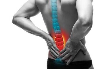 Остеохондрозата е заболяване на гръбначния стълб